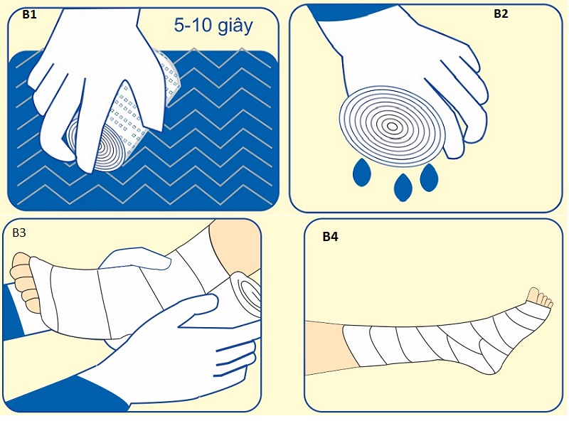 Bột bó sợi thủy tinh