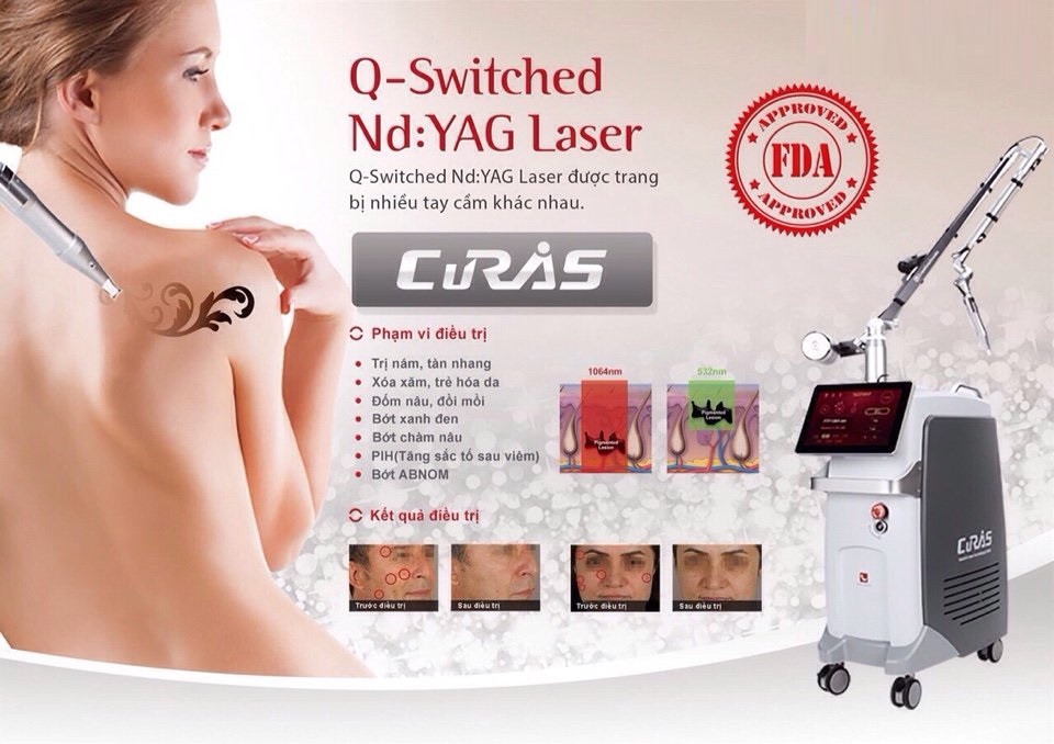 máy laser curas