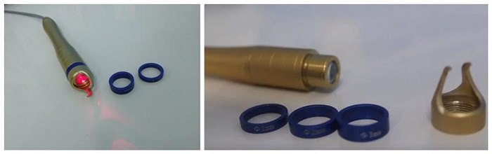 máy laser trị giãn mao mạch máu -1