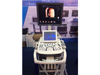 Máy siêu âm 5D Uistar sự lựa chọn hoàn hảo đối với các bác sỹ cho phòng khám sản khoa
