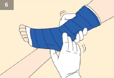 bột bó sợi thủy tinh -2
